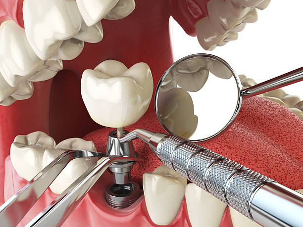 Best Emergency Denture Repair in Aristocrat Ranchettes, CO